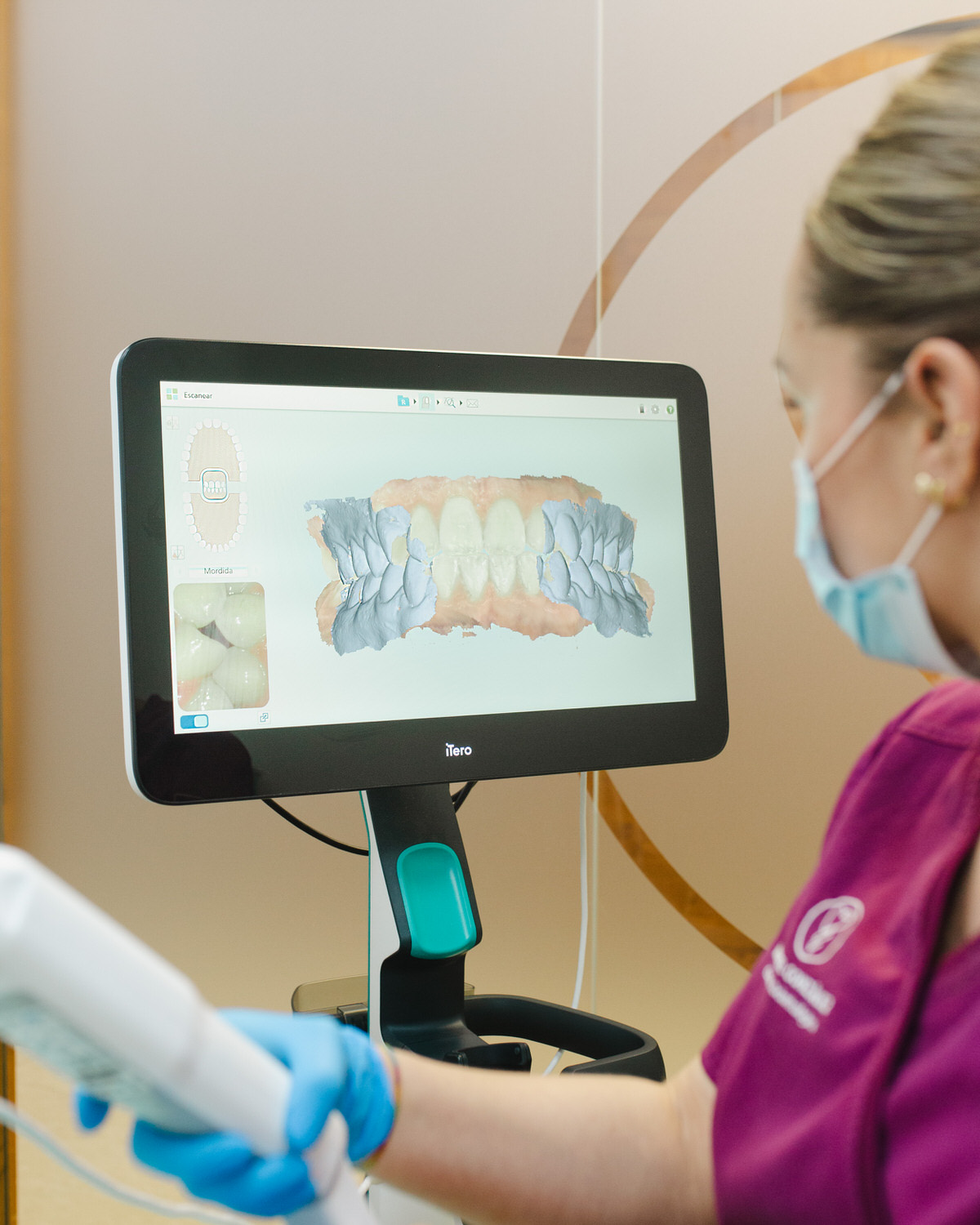 iTero Clinica Dental Oviedo